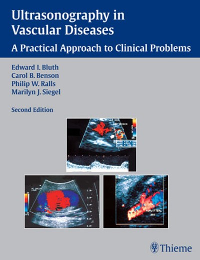 Ultrasonography in Vascular Diseases - A Practical Approach to Clinical Problems